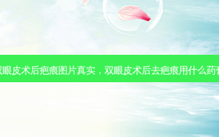 双眼皮术后疤痕图片真实，双眼皮术后去疤痕用什么药膏