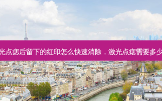 激光点痣后留下的红印怎么快速消除，激光点痣需要多少钱