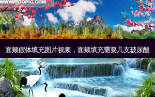 面颊假体填充图片视频，面颊填充需要几支玻尿酸