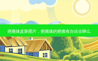 疤痕体皮肤图片，疤痕体的疤痕有办法去掉么
