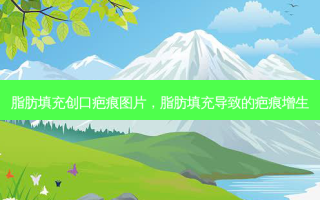 脂肪填充创口疤痕图片，脂肪填充导致的疤痕增生