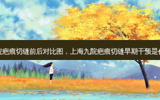 上海九院疤痕切缝前后对比图，上海九院疤痕切缝早期干预是什么时候