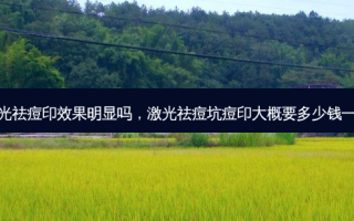 激光祛痘印效果明显吗，激光祛痘坑痘印大概要多少钱一次