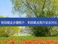 割双眼皮步骤图片，割双眼皮图片前后对比
