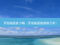 牙齿贴面多少钱（牙齿贴面能保持几年）