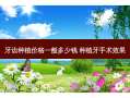 牙齿种植价格一般多少钱 种植牙手术效果