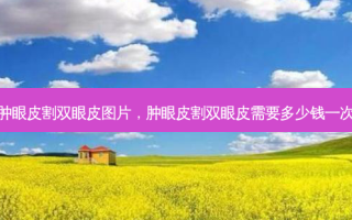 肿眼皮割双眼皮图片，肿眼皮割双眼皮需要多少钱一次