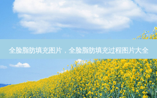全脸脂肪填充图片，全脸脂肪填充过程图片大全