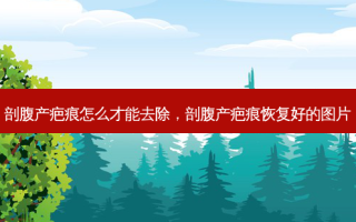 剖腹产疤痕怎么才能去除，剖腹产疤痕恢复好的图片