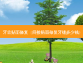 牙齿贴面修复（间接贴面修复牙缝多少钱）