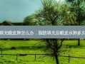 脂肪填充眼皮肿怎么办，脂肪填充后眼皮水肿多久消失