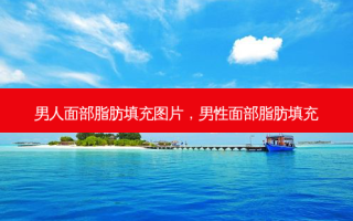 男人面部脂肪填充图片，男性面部脂肪填充