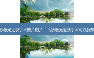 飞秒激光近视手术照片图片，飞秒激光近视手术可以报销吗