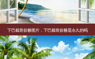 下巴截骨前移图片，下巴截骨前移是永久的吗