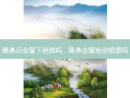 隆鼻后会留下疤痕吗，隆鼻会留疤会明显吗