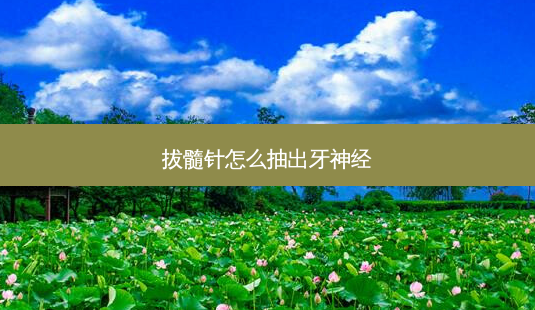 拔髓针怎么抽出牙神经-第1张图片-容颜志 - 专注变美资讯