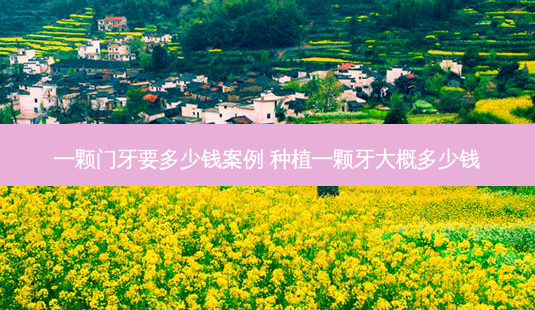 一颗门牙要多少钱案例 种植一颗牙大概多少钱-第1张图片-容颜志 - 专注变美资讯 一颗门牙要多少钱案例 种植一颗牙大概多少钱-第1张图片-容颜志 - 专注变美资讯