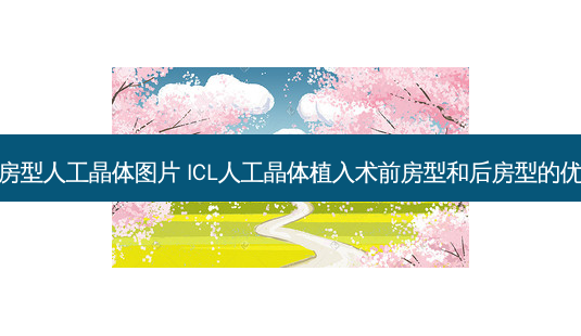 后房型人工晶体图片 ICL人工晶体植入术前房型和后房型的优劣-第1张图片-容颜志 - 专注变美资讯 后房型人工晶体图片 ICL人工晶体植入术前房型和后房型的优劣-第1张图片-容颜志 - 专注变美资讯