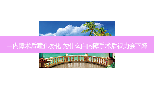 白内障术后瞳孔变化 为什么白内障手术后视力会下降-第1张图片-容颜志 - 专注变美资讯 白内障术后瞳孔变化 为什么白内障手术后视力会下降-第1张图片-容颜志 - 专注变美资讯