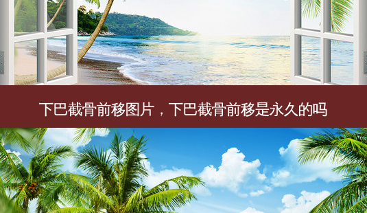 下巴截骨前移图片,下巴截骨前移是永久的吗-第1张图片-容颜志 - 专注变美资讯 下巴截骨前移图片,下巴截骨前移是永久的吗-第1张图片-容颜志 - 专注变美资讯