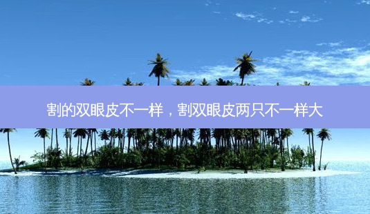 割的双眼皮不一样,割双眼皮两只不一样大-第1张图片-容颜志 - 专注变美资讯 割的双眼皮不一样,割双眼皮两只不一样大-第1张图片-容颜志 - 专注变美资讯