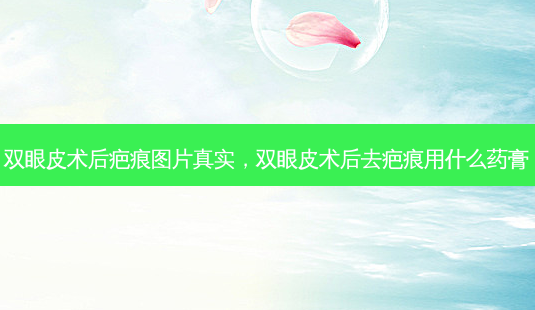 双眼皮术后疤痕图片真实,双眼皮术后去疤痕用什么药膏-第1张图片-容颜志 - 专注变美资讯 双眼皮术后疤痕图片真实,双眼皮术后去疤痕用什么药膏-第1张图片-容颜志 - 专注变美资讯