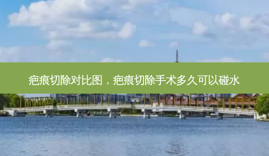 疤痕切除对比图，疤痕切除手术多久可以碰水-第1张图片-容颜志 - 专注变美资讯