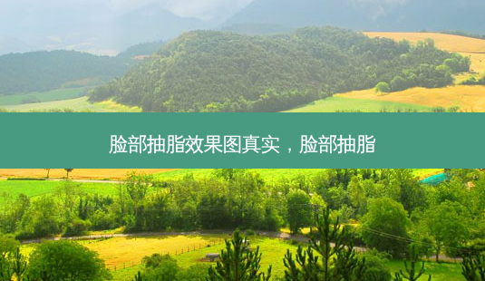 脸部抽脂效果图真实，脸部抽脂-第1张图片-容颜志 - 专注变美资讯