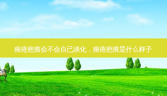 痤疮疤痕会不会自己淡化,痤疮疤痕是什么样子-第1张图片-容颜志 - 专注变美资讯 痤疮疤痕会不会自己淡化,痤疮疤痕是什么样子-第1张图片-容颜志 - 专注变美资讯