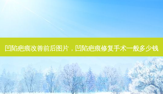 凹陷疤痕改善前后图片,凹陷疤痕修复手术一般多少钱-第1张图片-容颜志 - 专注变美资讯 凹陷疤痕改善前后图片,凹陷疤痕修复手术一般多少钱-第1张图片-容颜志 - 专注变美资讯