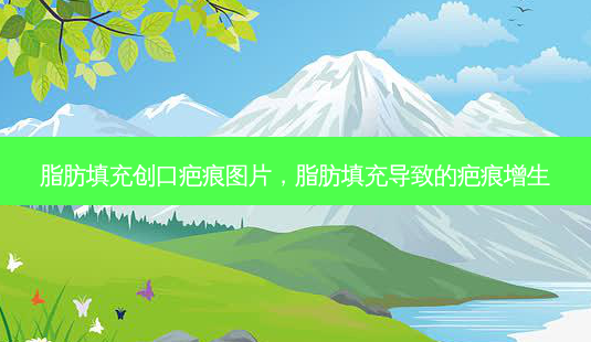 脂肪填充创口疤痕图片,脂肪填充导致的疤痕增生-第1张图片-容颜志 - 专注变美资讯 脂肪填充创口疤痕图片,脂肪填充导致的疤痕增生-第1张图片-容颜志 - 专注变美资讯