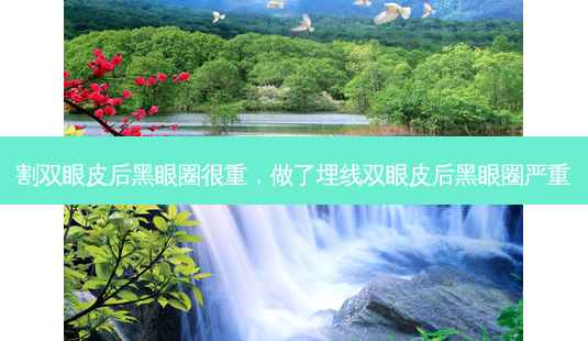 割双眼皮后黑眼圈很重,做了埋线双眼皮后黑眼圈严重-第1张图片-容颜志 - 专注变美资讯 割双眼皮后黑眼圈很重,做了埋线双眼皮后黑眼圈严重-第1张图片-容颜志 - 专注变美资讯
