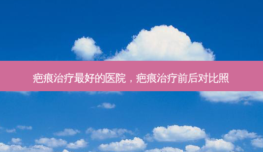 疤痕治疗 *** 的医院,疤痕治疗前后对比照-第1张图片-容颜志 - 专注变美资讯 疤痕治疗 *** 的医院,疤痕治疗前后对比照-第1张图片-容颜志 - 专注变美资讯