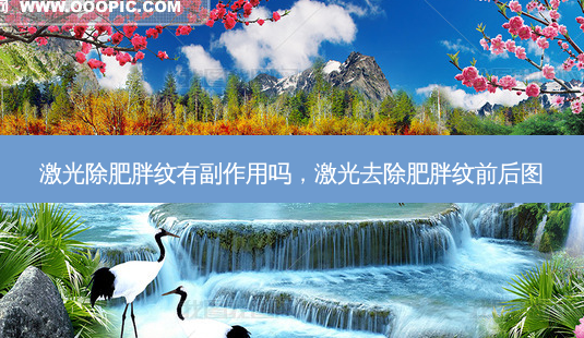 激光除肥胖纹有副作用吗,激光去除肥胖纹前后图-第1张图片-容颜志 - 专注变美资讯 激光除肥胖纹有副作用吗,激光去除肥胖纹前后图-第1张图片-容颜志 - 专注变美资讯