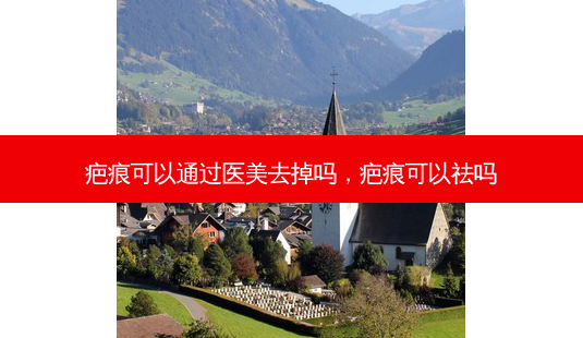 疤痕可以通过医美去掉吗,疤痕可以祛吗-第1张图片-容颜志 - 专注变美资讯 疤痕可以通过医美去掉吗,疤痕可以祛吗-第1张图片-容颜志 - 专注变美资讯