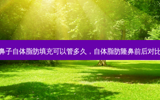 鼻子自体脂肪填充可以管多久，自体脂肪隆鼻前后对比