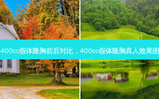 400cc假体隆胸前后对比，400cc假体隆胸真人效果图