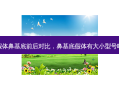 假体鼻基底前后对比，鼻基底假体有大小型号吗